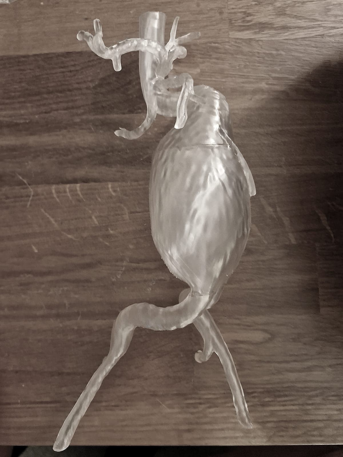 Clear resin 3D-printed model of an abdominal aortic aneurysm produced from medical imaging