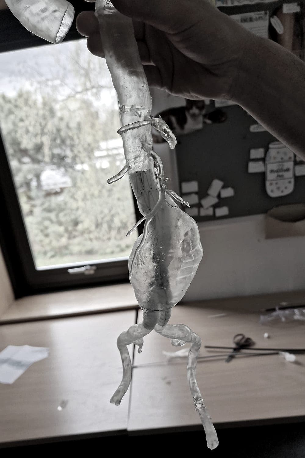 Aortic aneurysm model held up to the light, showing the translucent resin wall